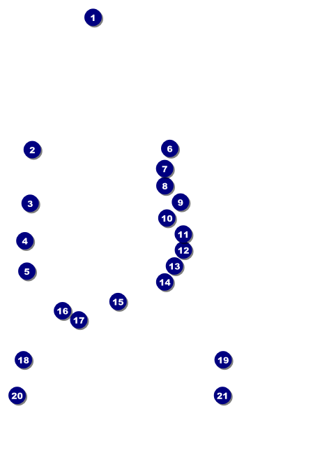 Bowling Classic Postcard Front Field Markers